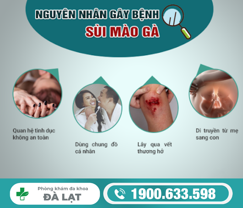 Hình ảnh minh họa